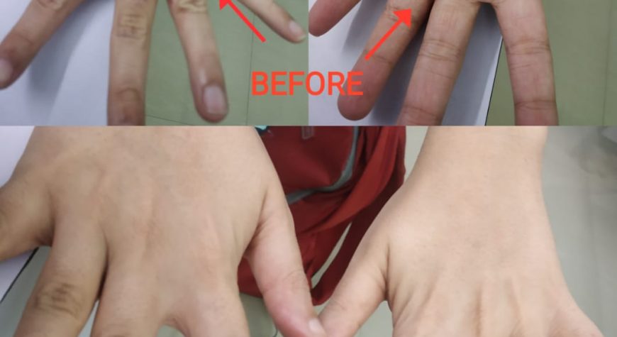 Eczema Clinic 1 Eczema