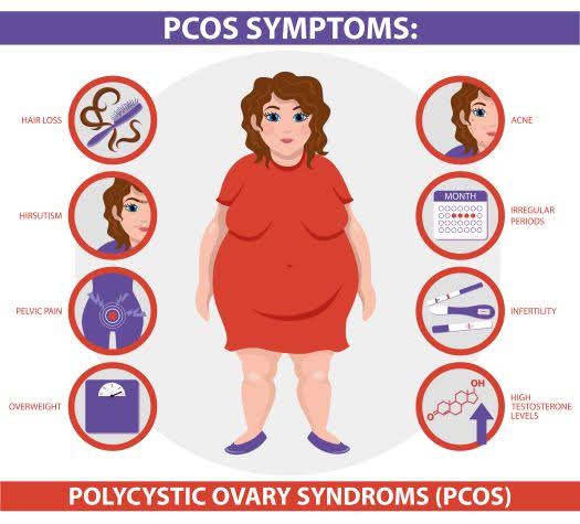 PCOS Clinic 1 Homoeopathy for PCOS PCOS Irregular menses
